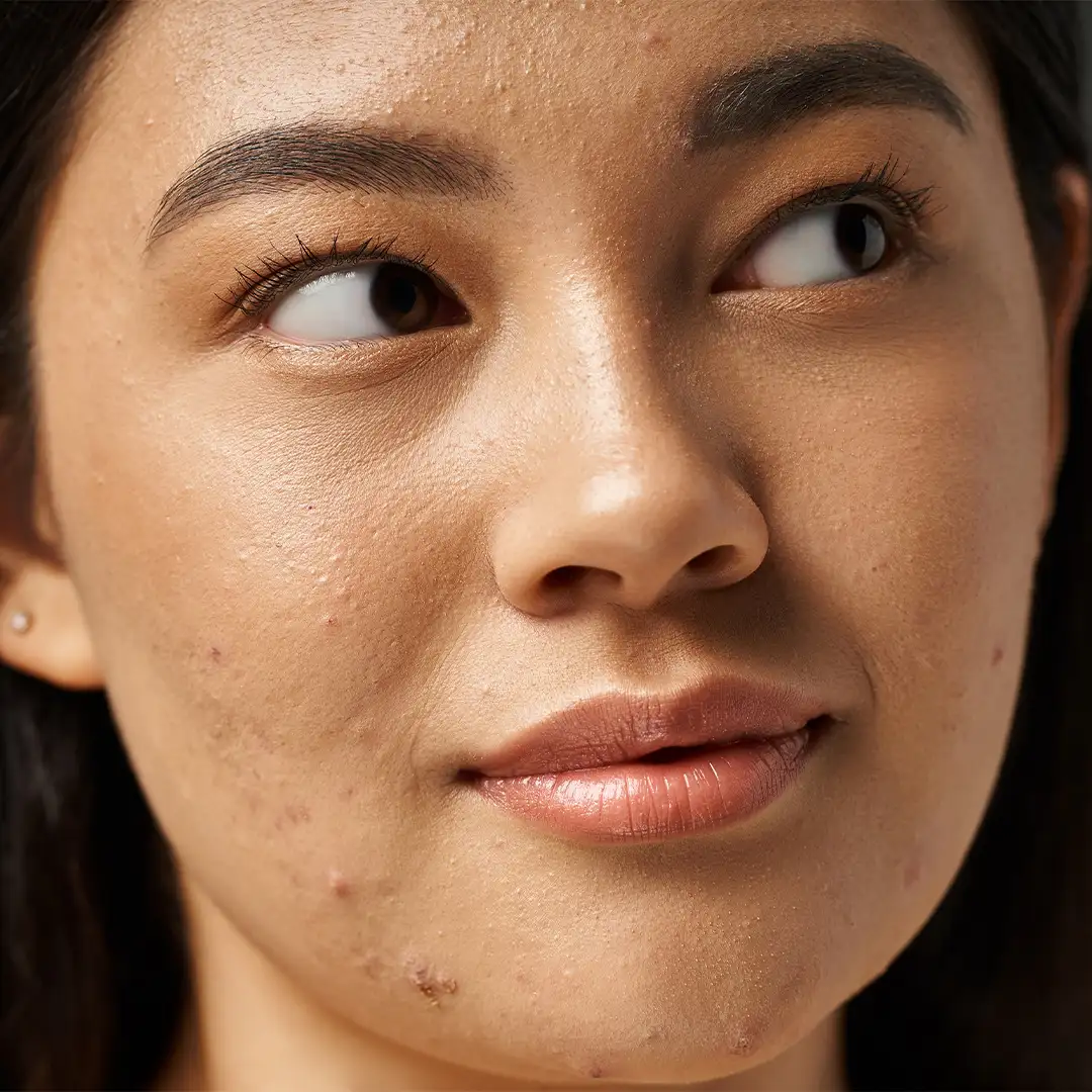 SKINPURE | Complément alimentaire en gélules